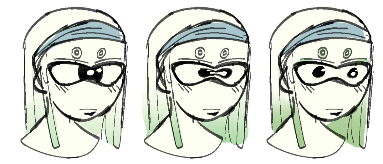 10-12 Child Subject undergoing iris mitosis developed: Pupile heterochromia and lazy eye