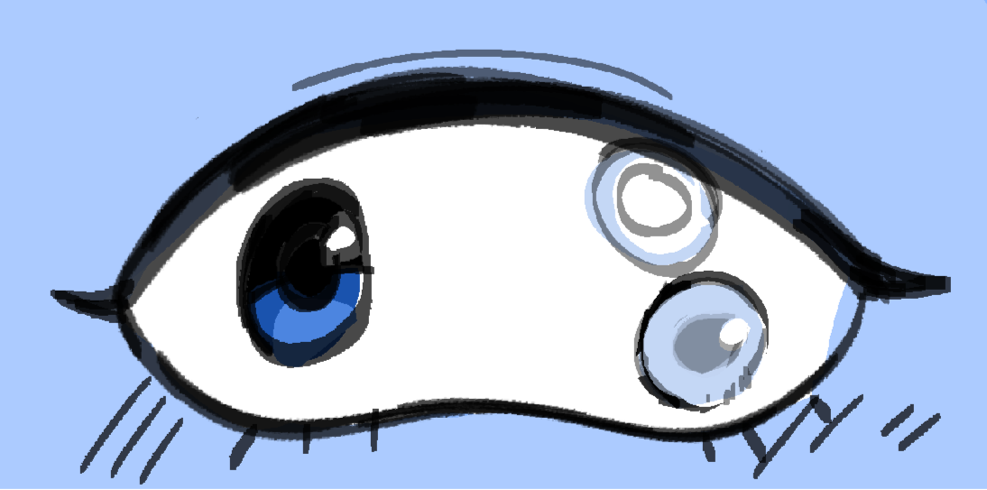 Subject with cluster eye condition: Lazy eye, pupula duplex and Monocular Vision.